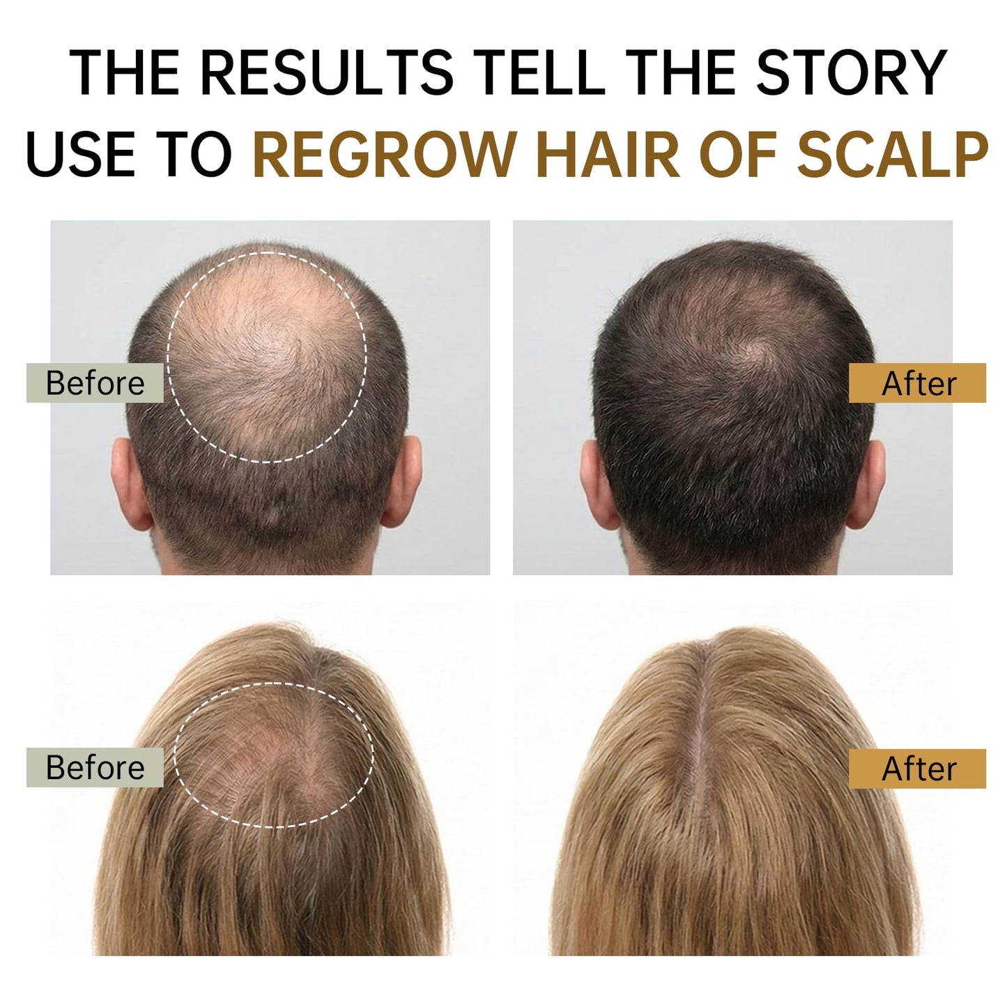 XILRVON Ginger Root and Biotin infused lightweight hair spray formulation texture visual