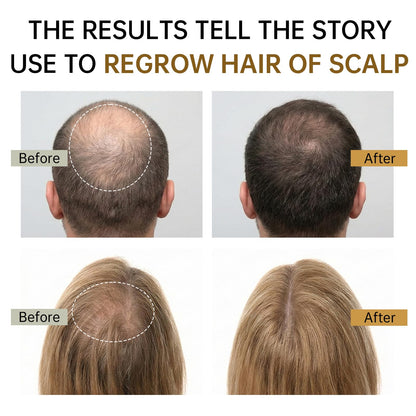 XILRVON Ginger Root and Biotin infused lightweight hair spray formulation texture visual