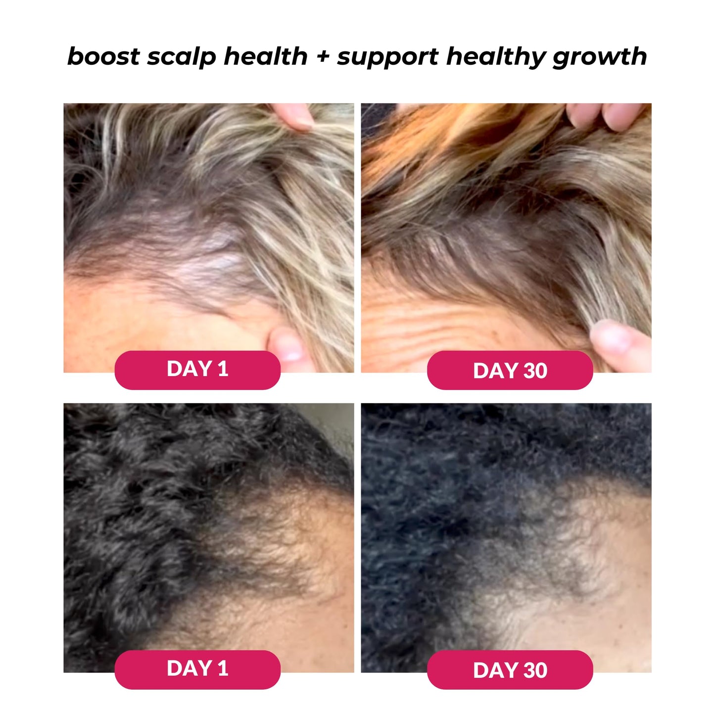 Love Ur Curls concentrated hair serum for deep scalp moisturizing and thinning hair