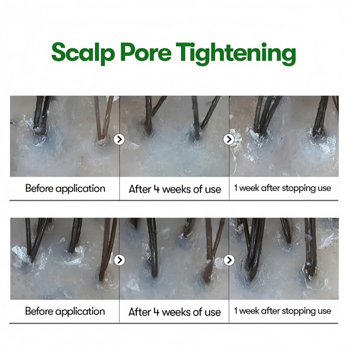 Close up of the built in applicator tip on the PDRN hair growth ampoule for targeted scalp care