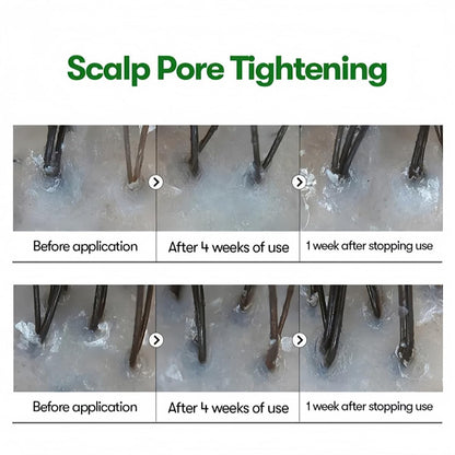 Close up of the built in applicator tip on the PDRN hair growth ampoule for targeted scalp care