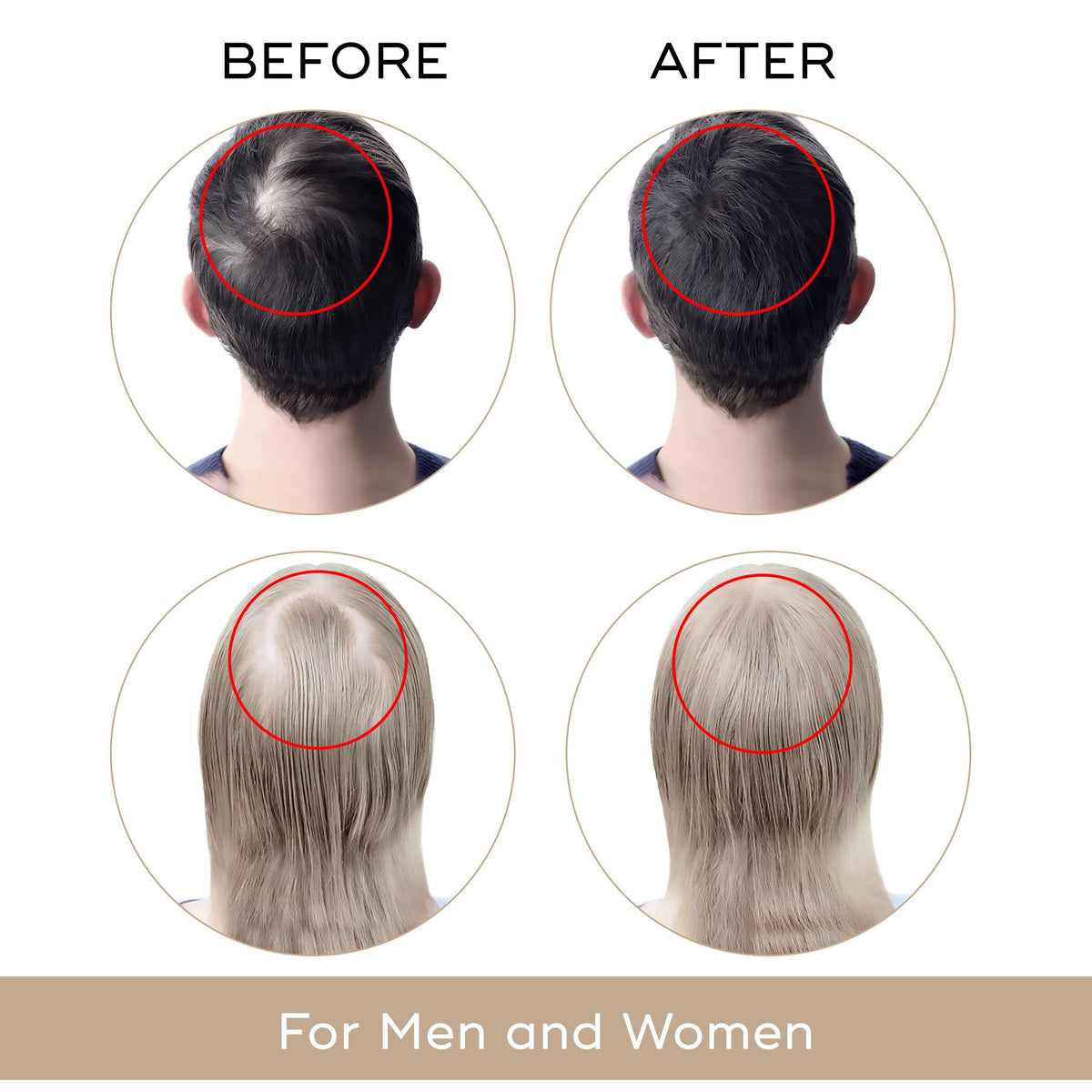 Charismo scalp treatment dropper bottle close up