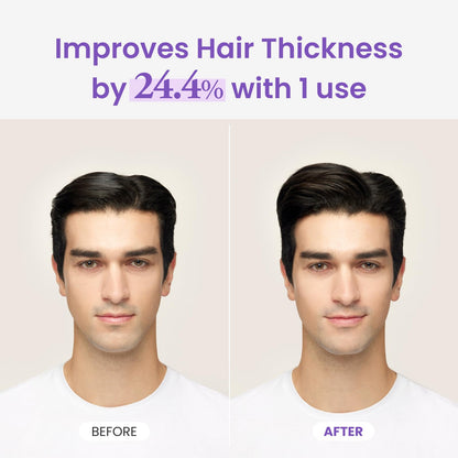 Applying Dr. Groot rosemary mint oil spray directly to roots for volume boost