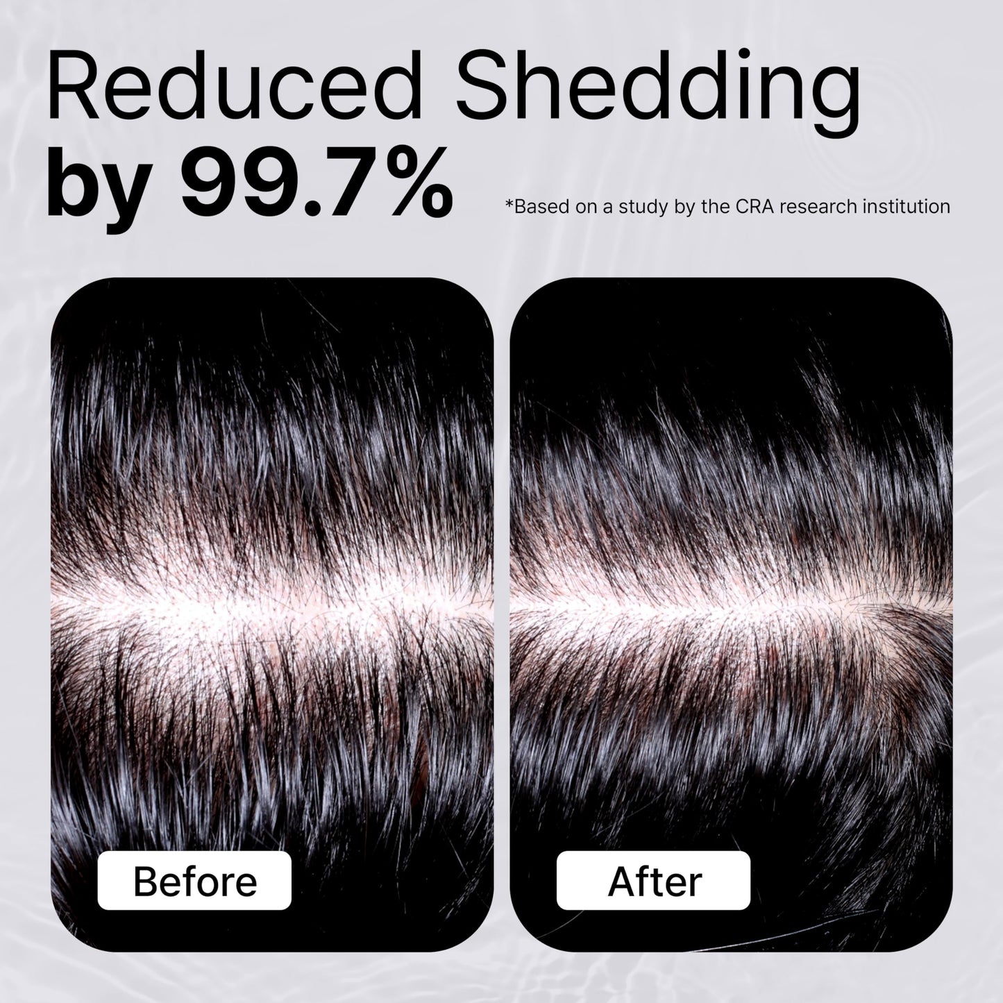 Refilled Cytokine Booster Plus scalp treatment showcasing the built in silicone nozzle massager.