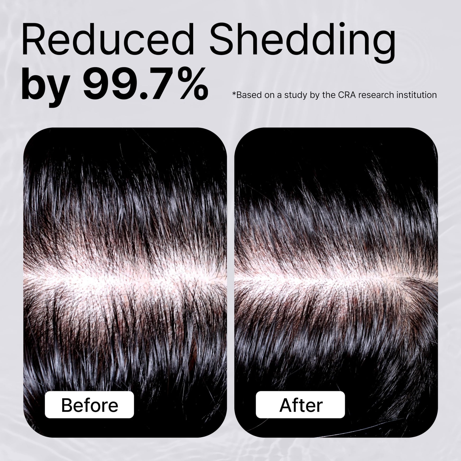 Refilled Cytokine Booster Plus scalp treatment showcasing the built in silicone nozzle massager.