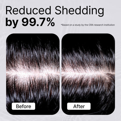 Refilled Cytokine Booster Plus scalp treatment showcasing the built in silicone nozzle massager.