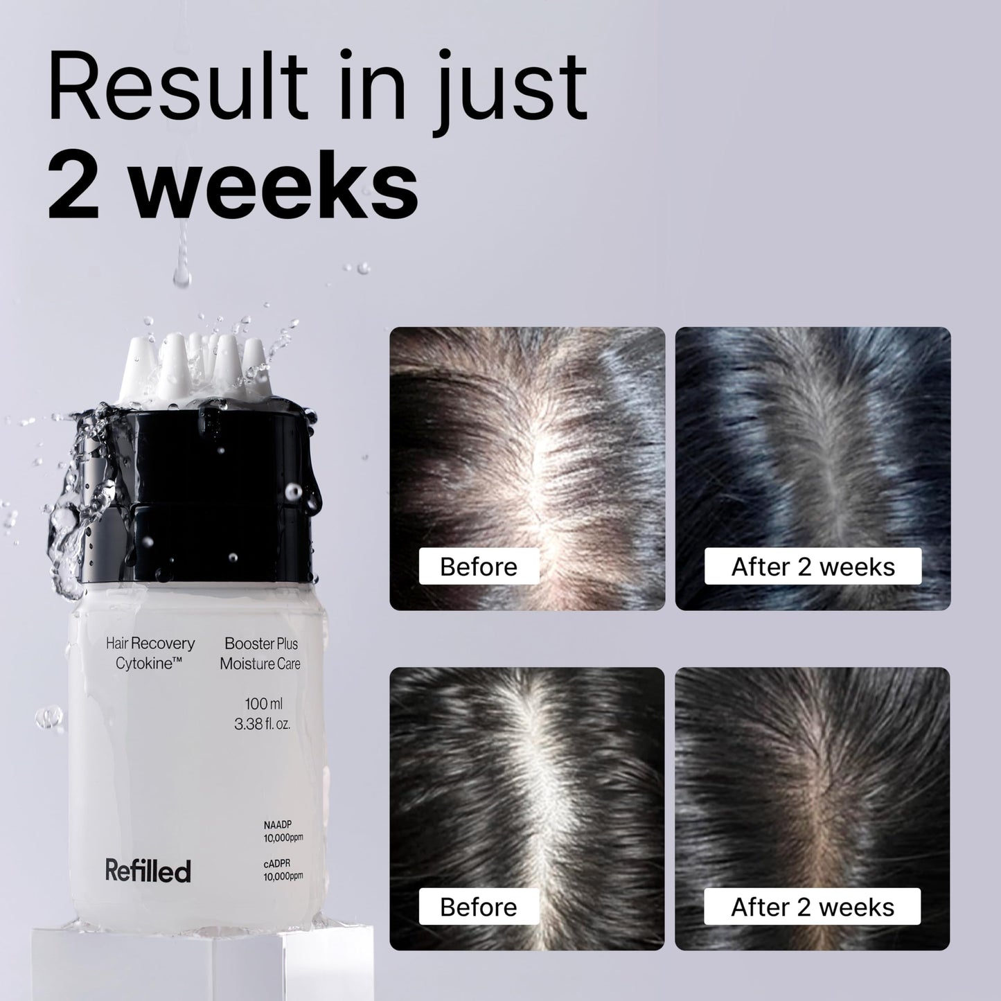 Lightweight non greasy hair growth serum being applied to thinning hair roots.