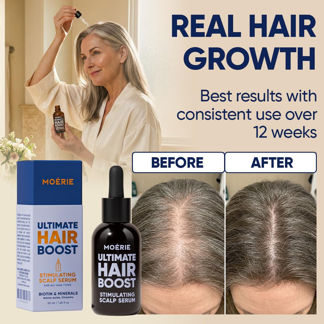 Moerie hair thinning treatment liquid texture demonstration being applied to the scalp