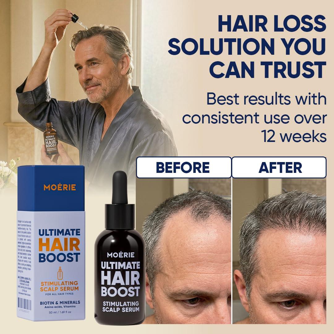 Moerie anti hair loss serum for women packaging box with detailed ingredients list