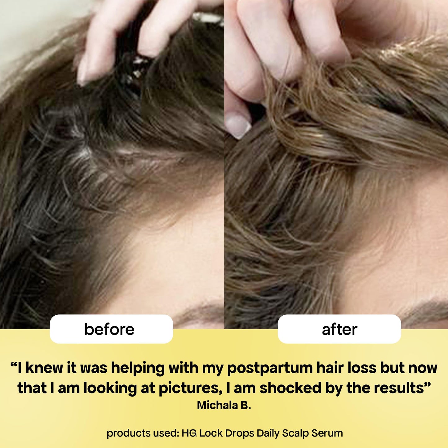 BondiBoost USA imported hair care solution for reducing daily hair shedding on dressing table