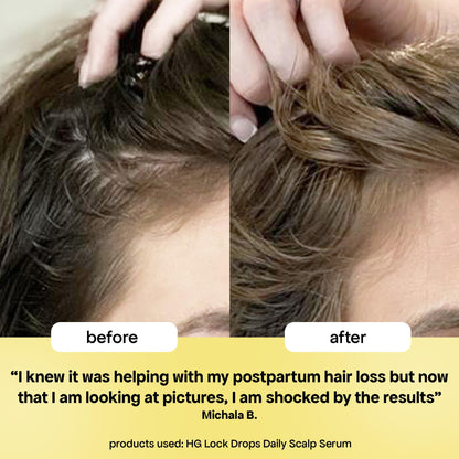 BondiBoost USA imported hair care solution for reducing daily hair shedding on dressing table
