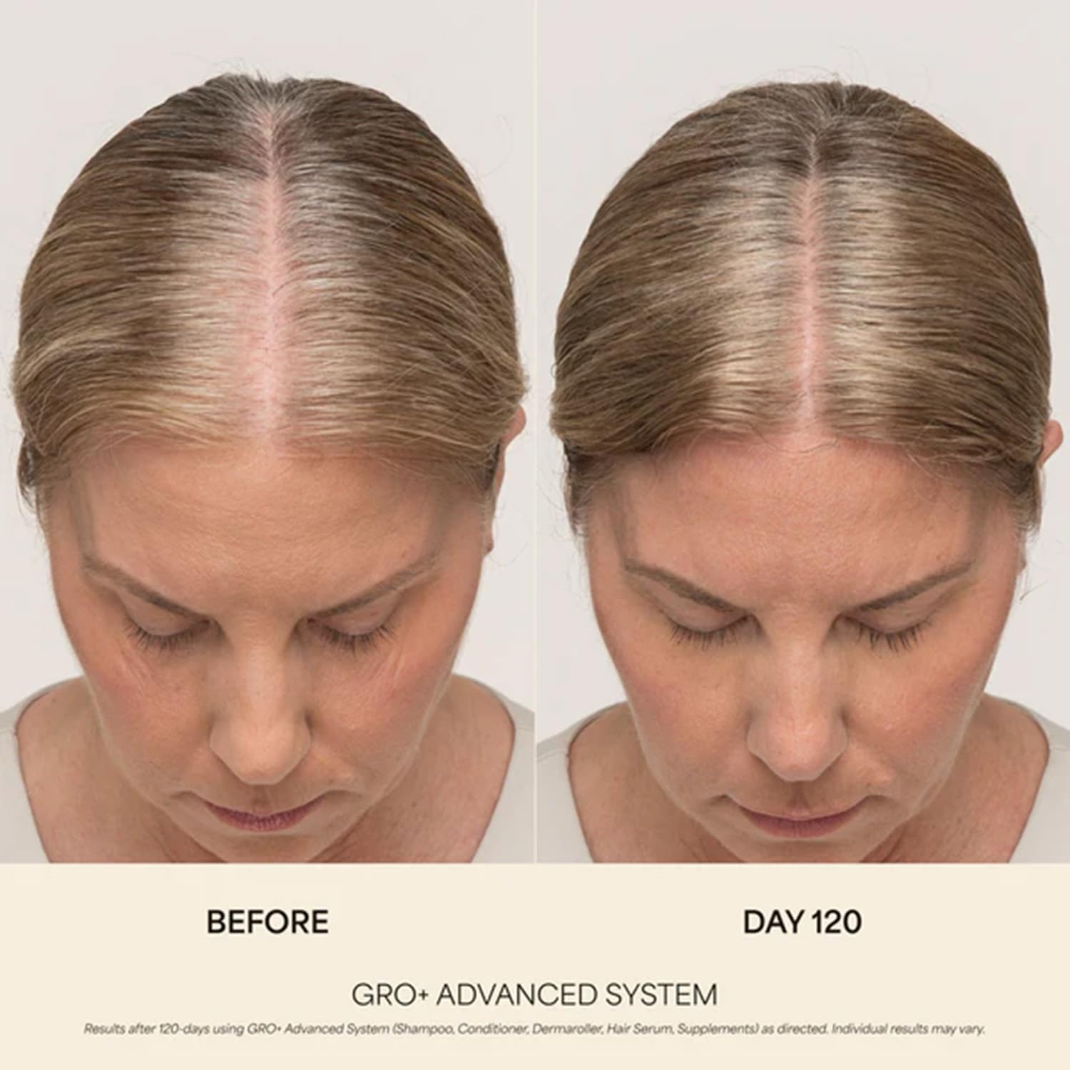 Vegamour GRO Plus Advanced Hair Serum complete application set showing the precise dropper mechanism for daily scalp use.