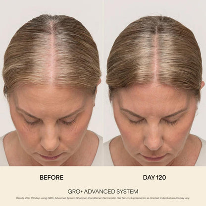 Vegamour GRO Plus Advanced Hair Serum complete application set showing the precise dropper mechanism for daily scalp use.