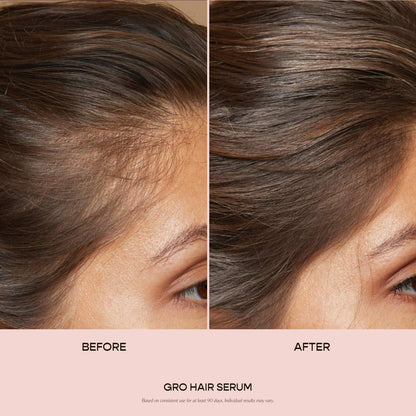 Vegamour plant based hair serum for thinning and shedding with dropper applicator