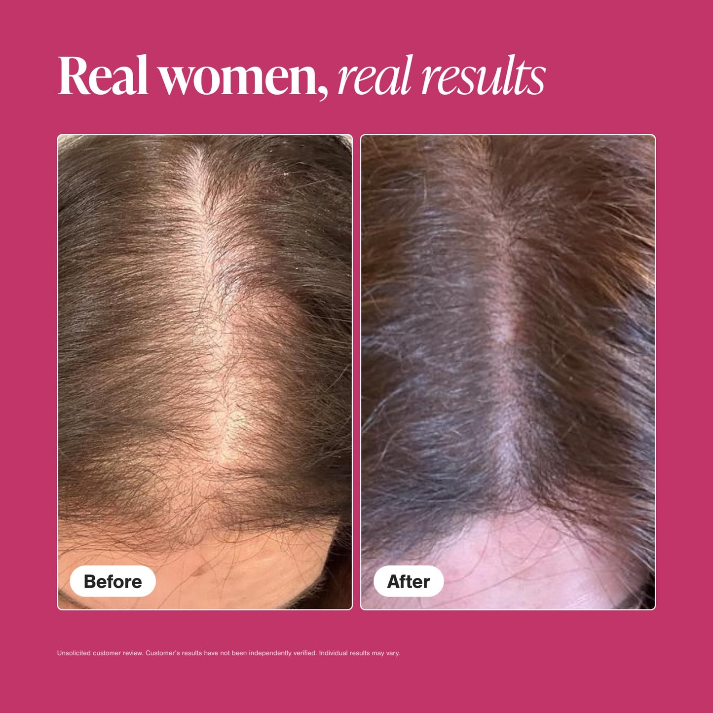 Viviscal women hair growth supplement one month supply bottle