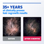 Men hair regrowth treatment active ingredient label information