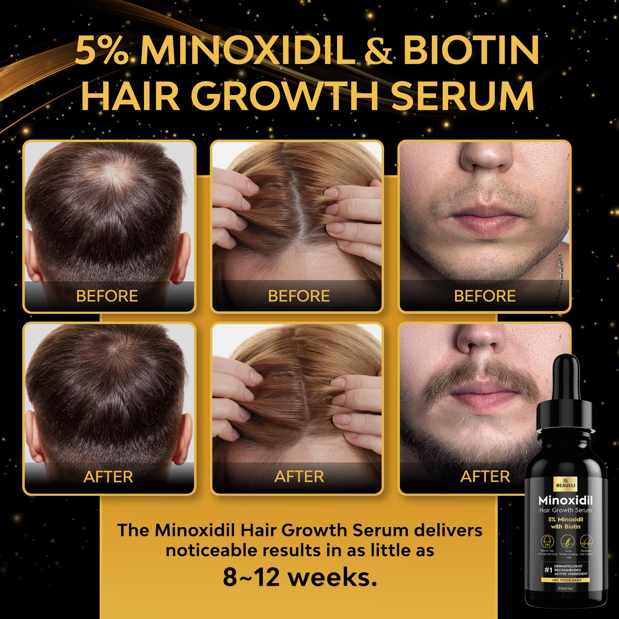 Beaueli topical minoxidil and biotin formula for unisex adult hair restoration.