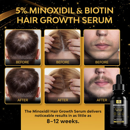 Beaueli topical minoxidil and biotin formula for unisex adult hair restoration.
