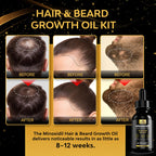 Beaueli minoxidil serum bottle with dropper applicator close up