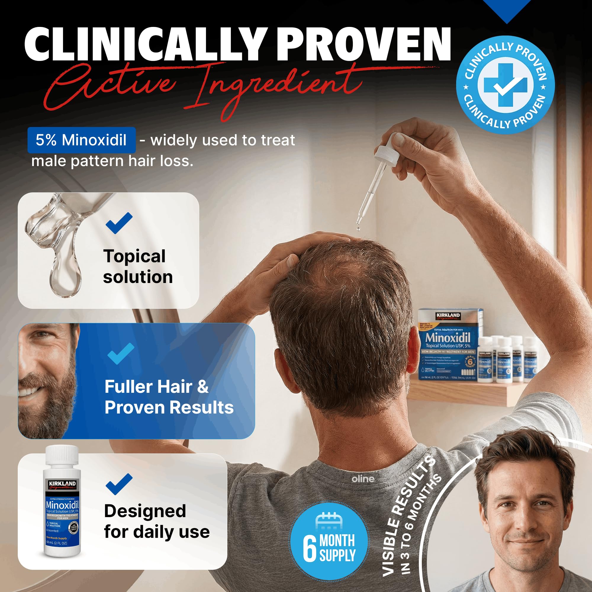 Six month supply bottles of topical hair regrowth treatment with dropper applicator