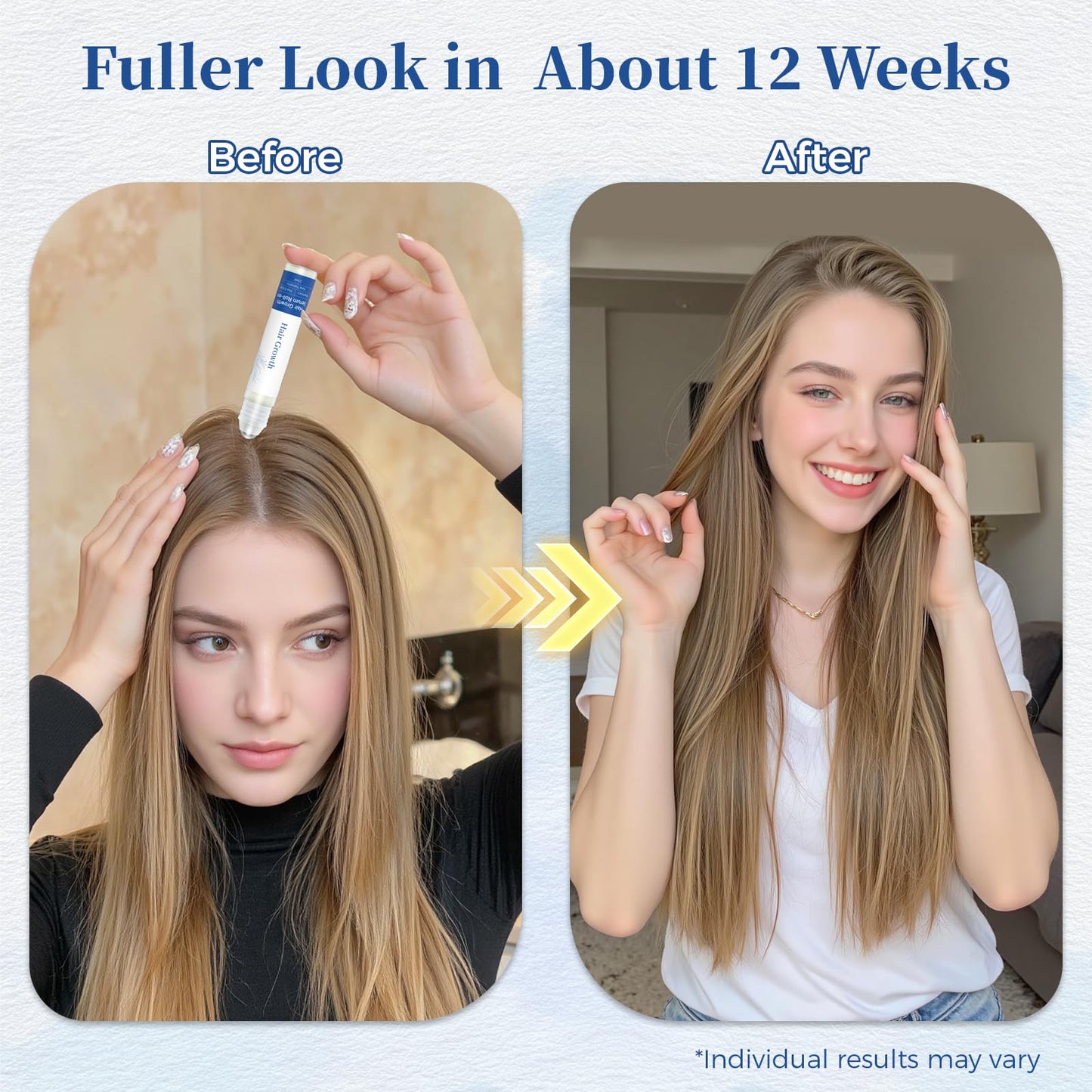 Gluvelessia hair growth roll on applicator being applied to the scalp hairline.
