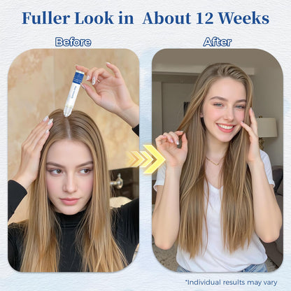 Gluvelessia hair growth roll on applicator being applied to the scalp hairline.