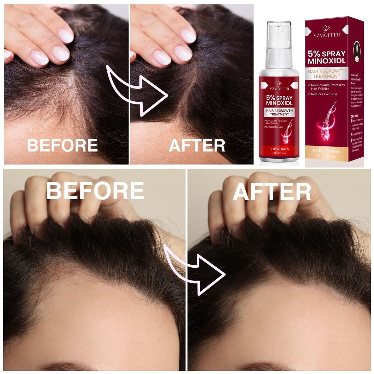 Authentic USA beauty and personal care treatment for thinning crowns and scalp revitalization