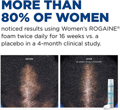 Top view of Regaine Women's Minoxidil foam container illustrating the specialized dispensing nozzle