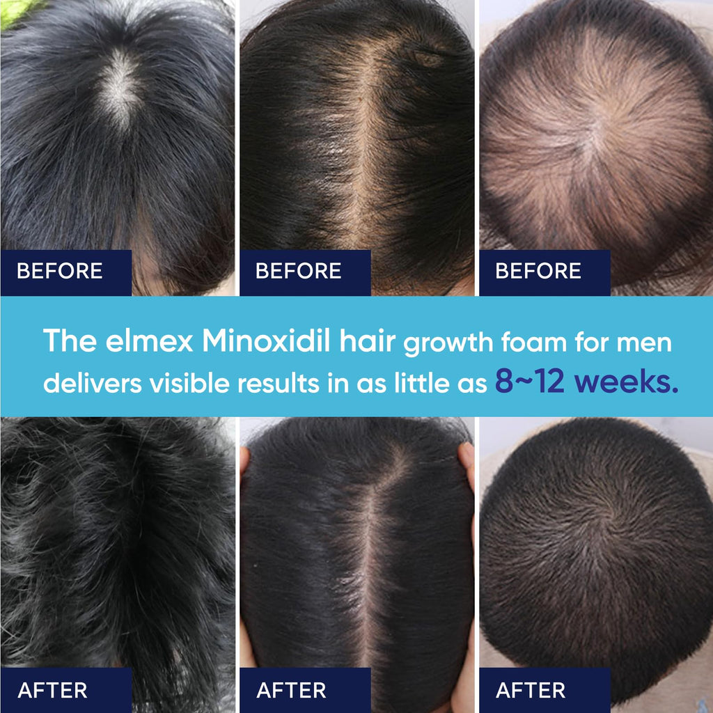 Artimore unscented minoxidil foam daily usage demonstration