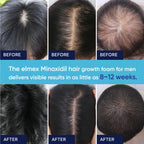 Artimore unscented minoxidil foam daily usage demonstration