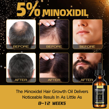 Stafenit 5 percent minoxidil dropper bottle showing application instructions on the label