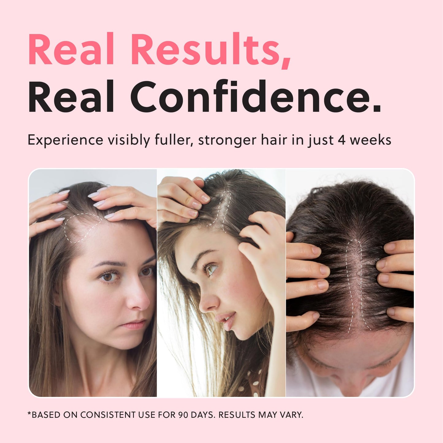 ForChics non greasy scalp spray packaging showing official brand labeling and benefits