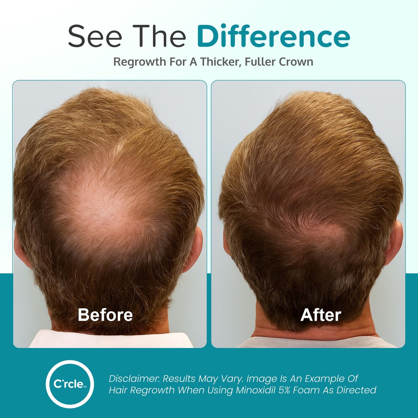 Authentic USA imported men hair loss foam packaging showing direction labels