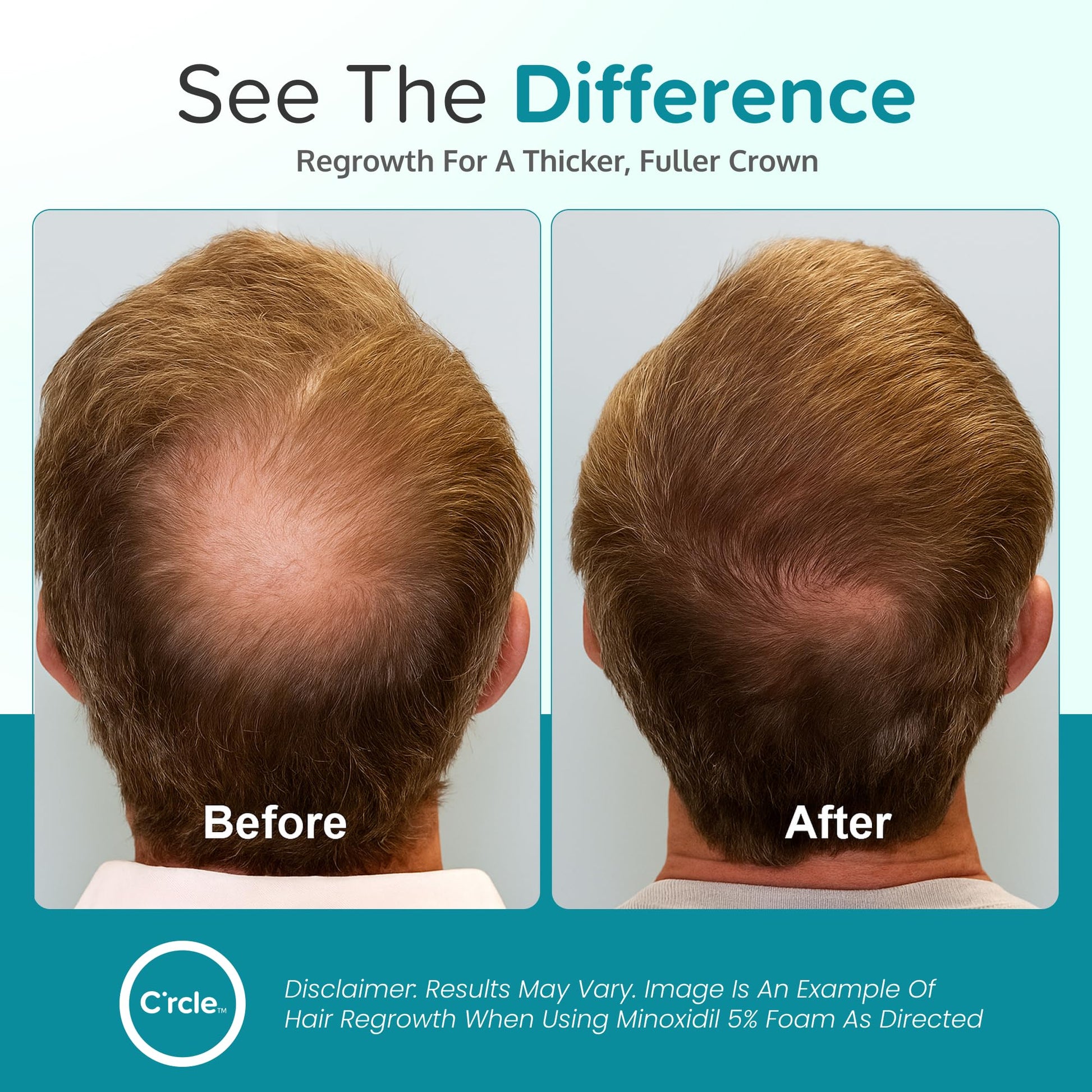 Authentic USA imported men hair loss foam packaging showing direction labels