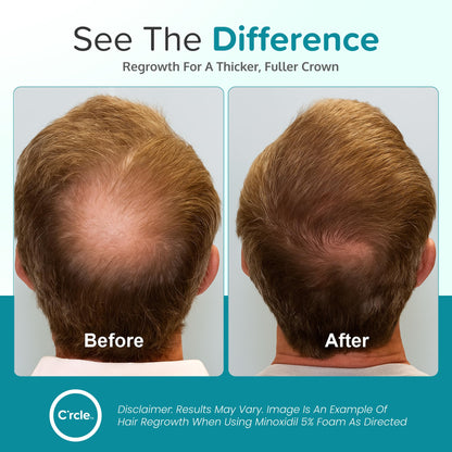 Authentic USA imported men hair loss foam packaging showing direction labels