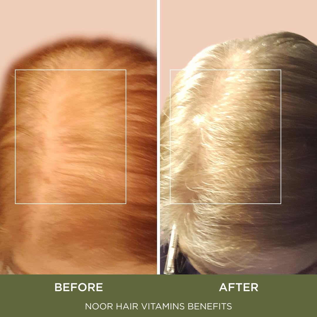 Noor Hair growth supplement supplement facts and ingredients label view