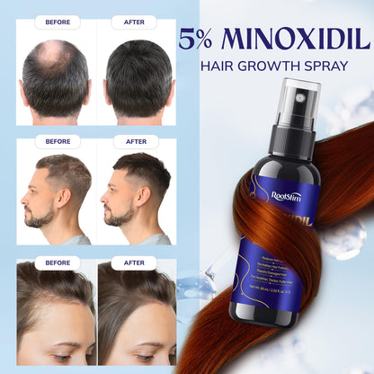 RootStim minoxidil 5 percent topical spray nozzle design