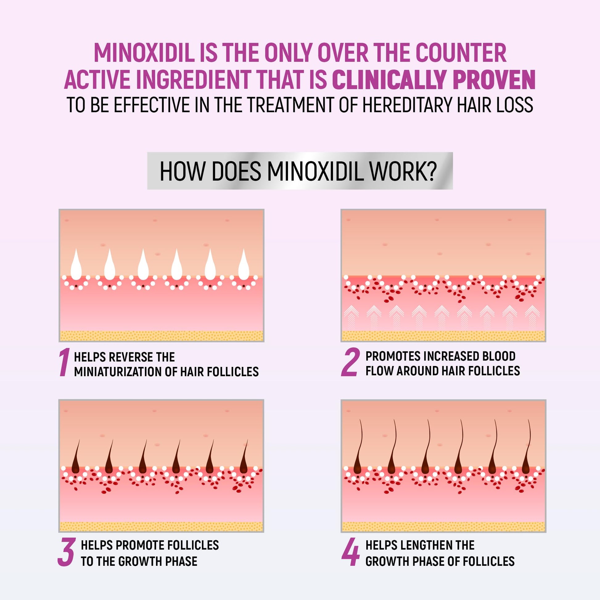 Imported USA Taro minoxidil foam for female hereditary hair loss