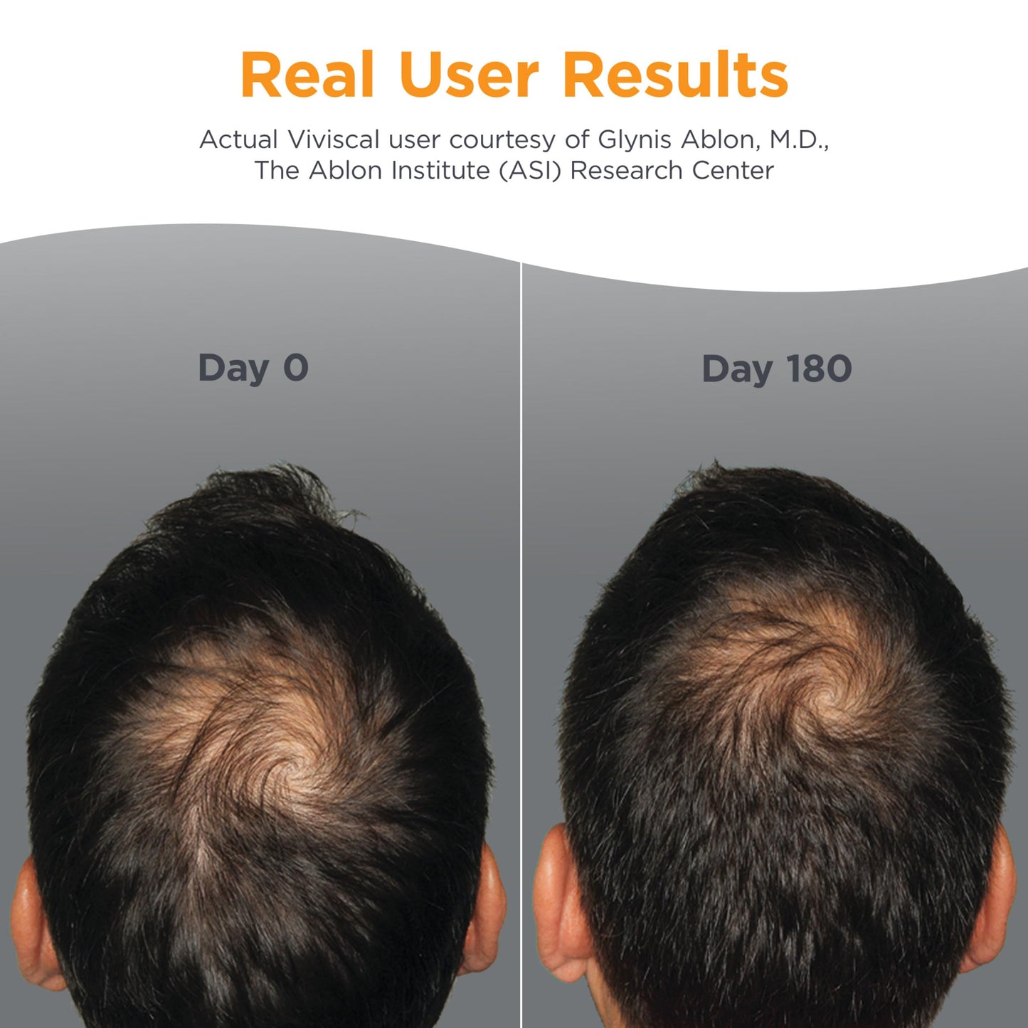 Viviscal Man advanced hair health supplement facts and ingredient list side panel