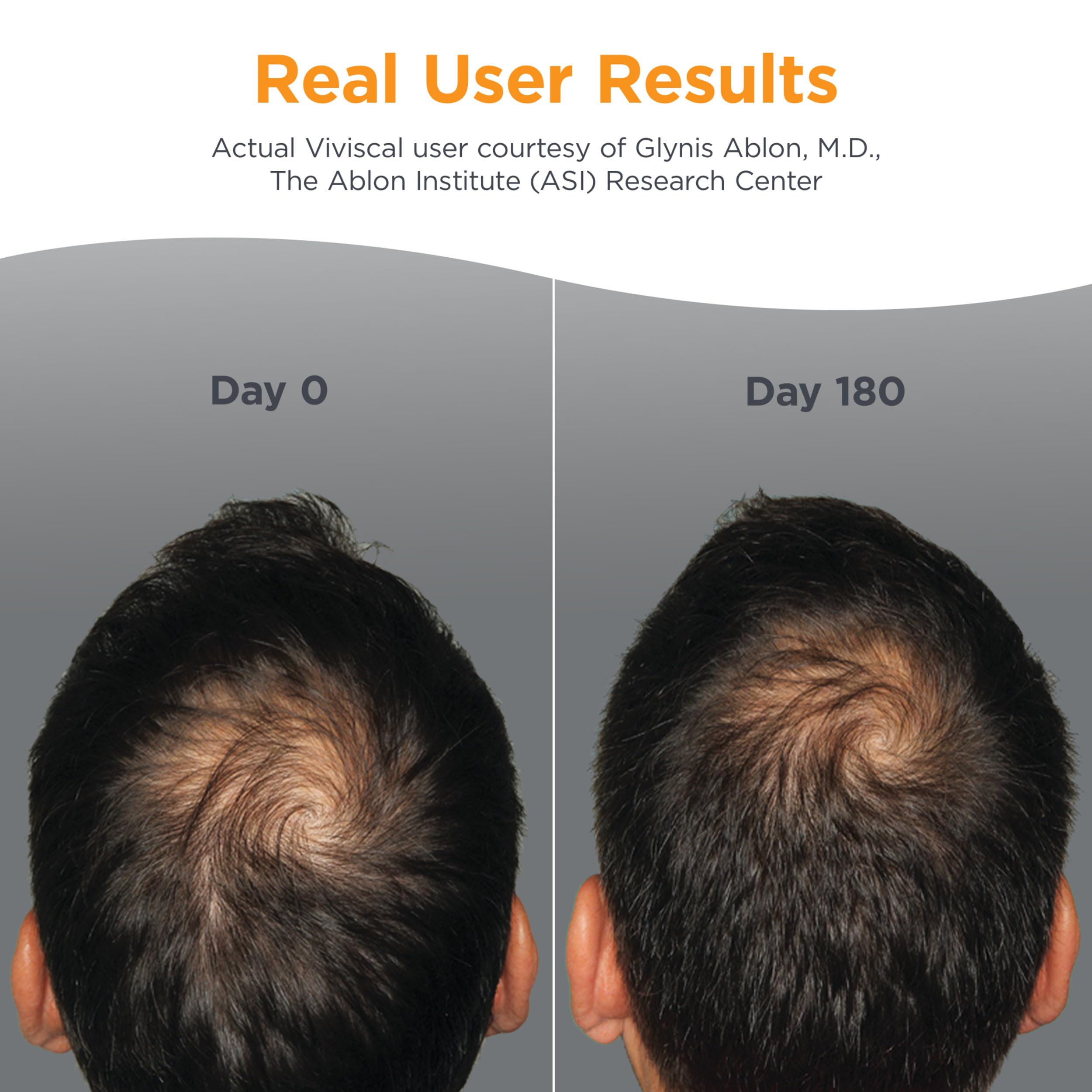 Viviscal Man advanced hair health supplement facts and ingredient list side panel