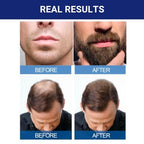 Kirkland Signature extra strength hair regrowth treatment bottle side product label