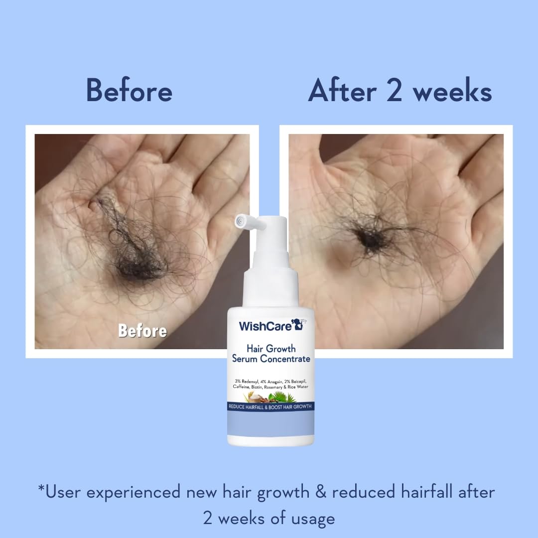 WishCare Rosemary and Rice Water hair serum for accelerating density and strengthening roots