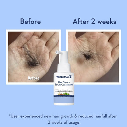 WishCare Rosemary and Rice Water hair serum for accelerating density and strengthening roots