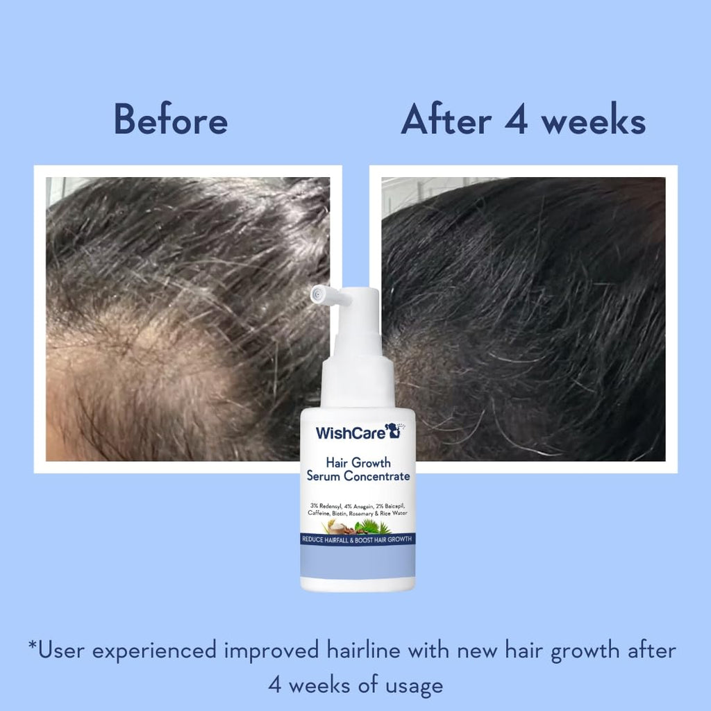 WishCare hair growth serum texture and lightweight consistency