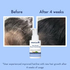 WishCare hair growth serum texture and lightweight consistency