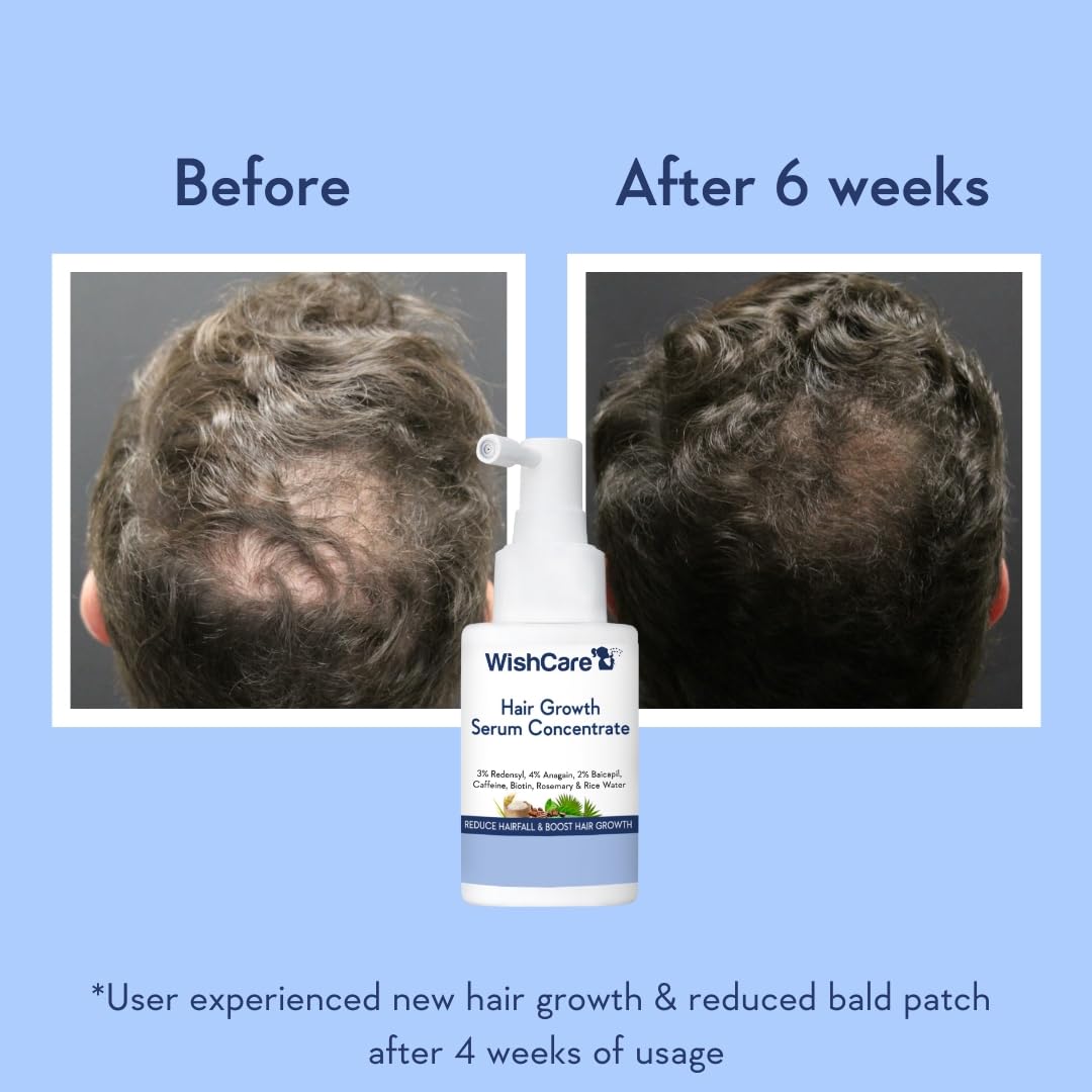 Side view of WishCare thirty milliliters hair growth treatment bottle showing lightweight texture details