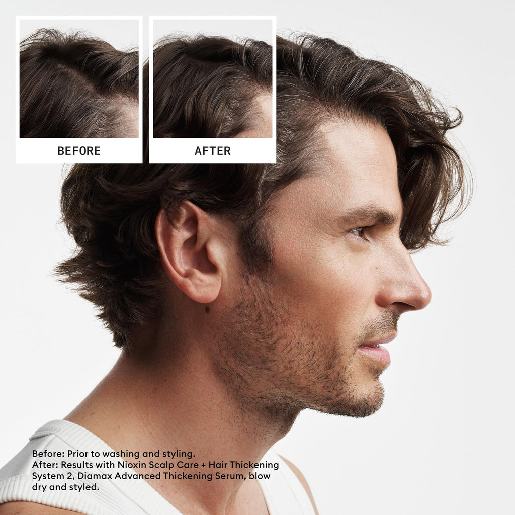 Nioxin System 2 treatment packaging showing product volume and details