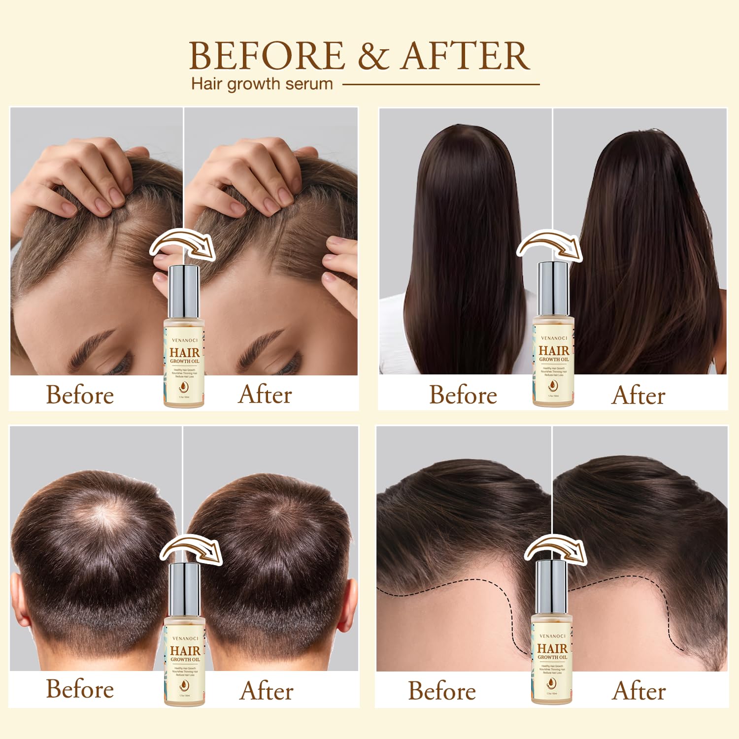 Venanoci Rosemary and Biotin Hair Serum close up shot