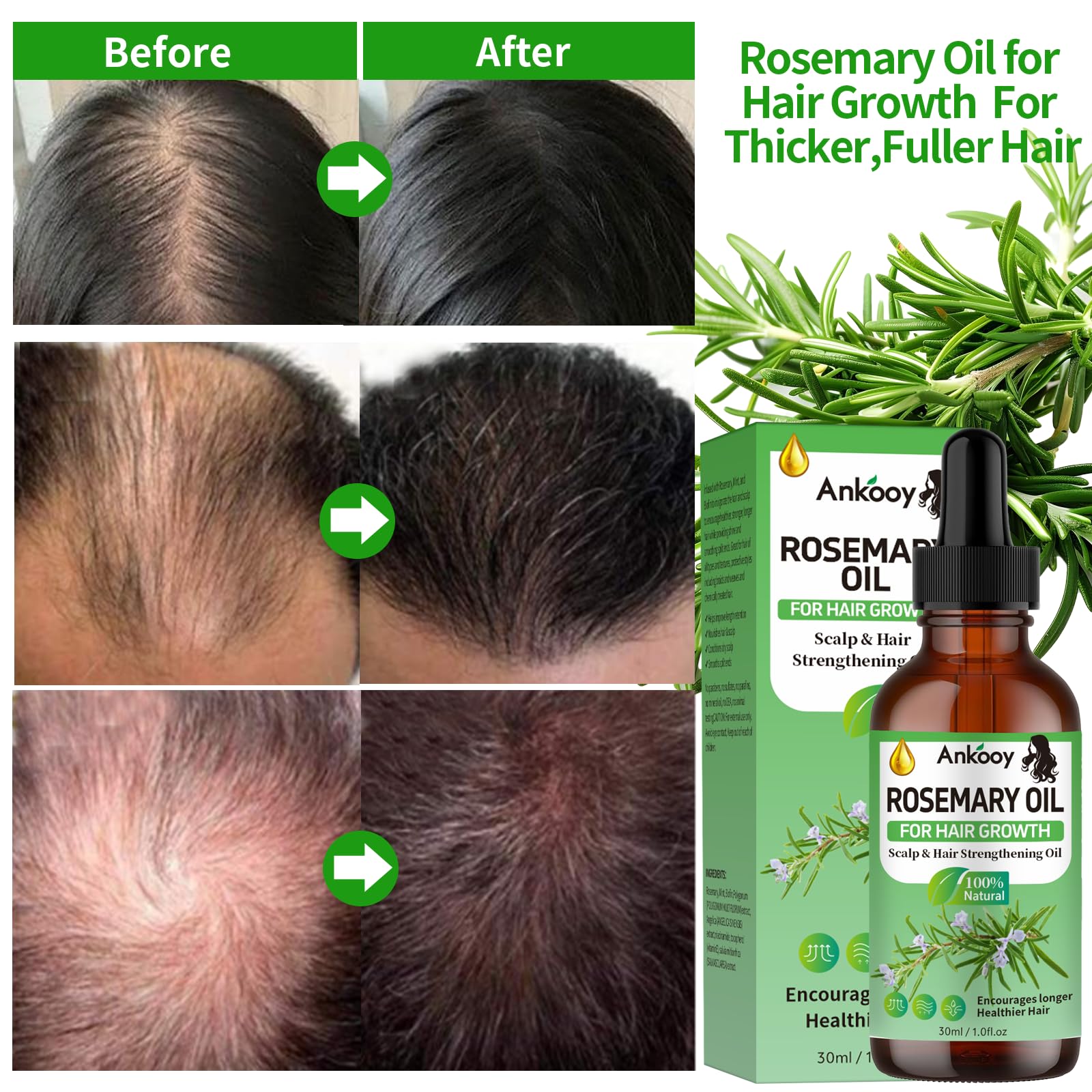 Two bottles of Ankooy Scalp Care Treatment showcasing the premium oil consistency