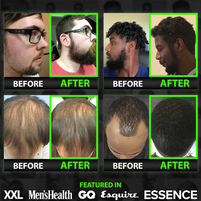 Close up of the dropper application for the maximum strength hair oil